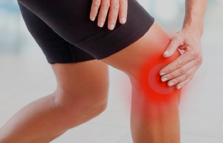 Arthritis