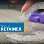 How to Clean Retainers